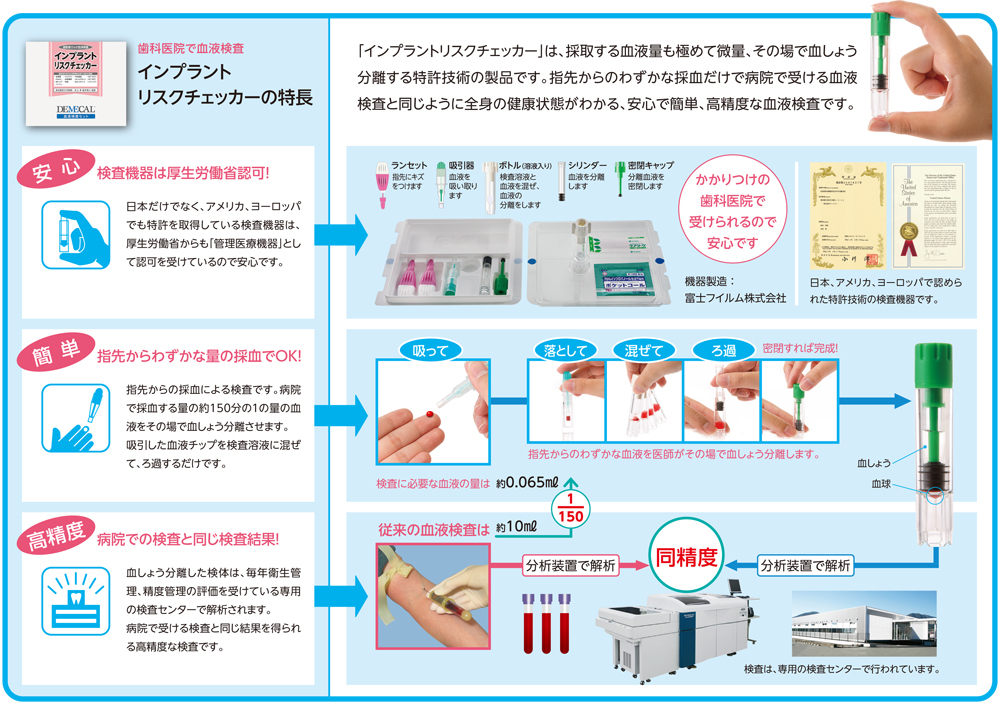 インプラント治療の術前審査 | 大川歯科医院