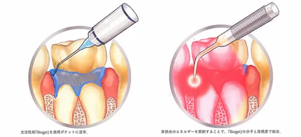 IMG_7672 | 大川歯科医院