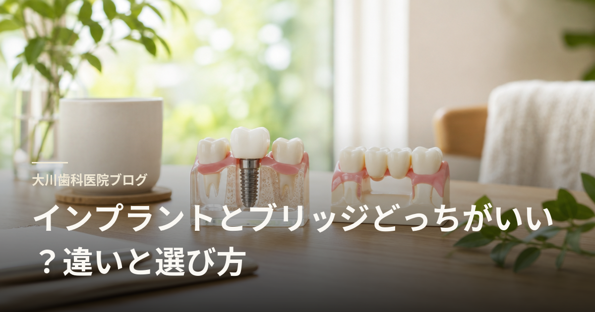 インプラントとブリッジどっちがいい？違いと選び方